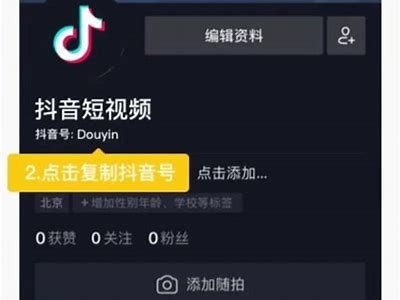 抖阴充值后没有金币的根本原因及解决方法详解